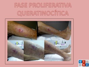 Diapositiva3